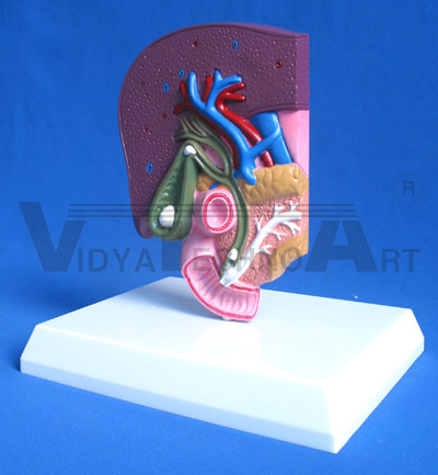 Concretion in gallbladder, neck of gallbladder, hepatopancreatic ampulla and common gallbladder duct